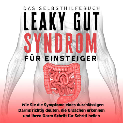 Hoerbuch Leaky Gut Syndrom für Einsteiger - Das Selbsthilfebuch: Wie Sie die Symptome eines durchlässigen Darms richtig deuten, die Ursachen erkennen und Ihren Darm Schritt für Schritt heilen - Christoph Beckonert - Yvonne Radtke